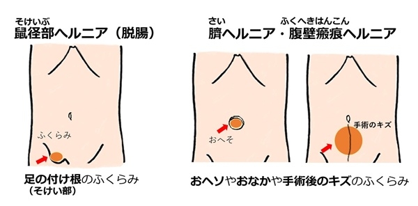 onaka2026-02.jpg
